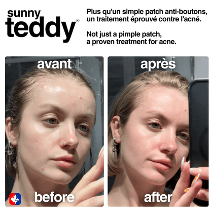 Cute Teddy Acne & Pimple Patchs  - Pink Teddies